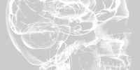 cerebral2